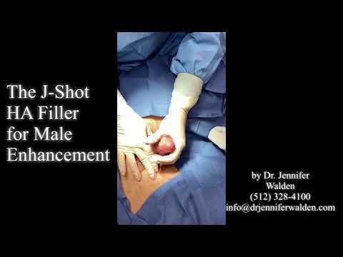 The “J-Shot” Dermal Filler for Male Enhancement