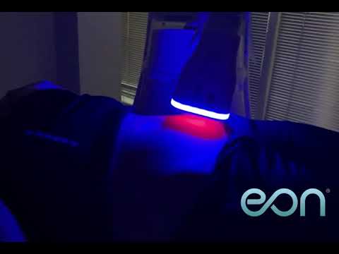 EON Touchless Robotic Laser Fat Reduction - First in Austin!